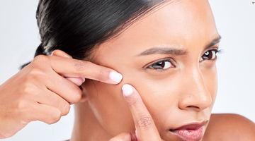 Acne & Breakouts: Causes, Prevention, and Treatment Options For Acne